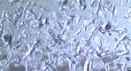 E-Coat damaged by stone chips