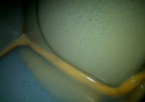 Versiegelte Spalte im Hohlraum