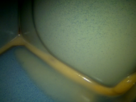 Korrosionsschutz im Hohlraum